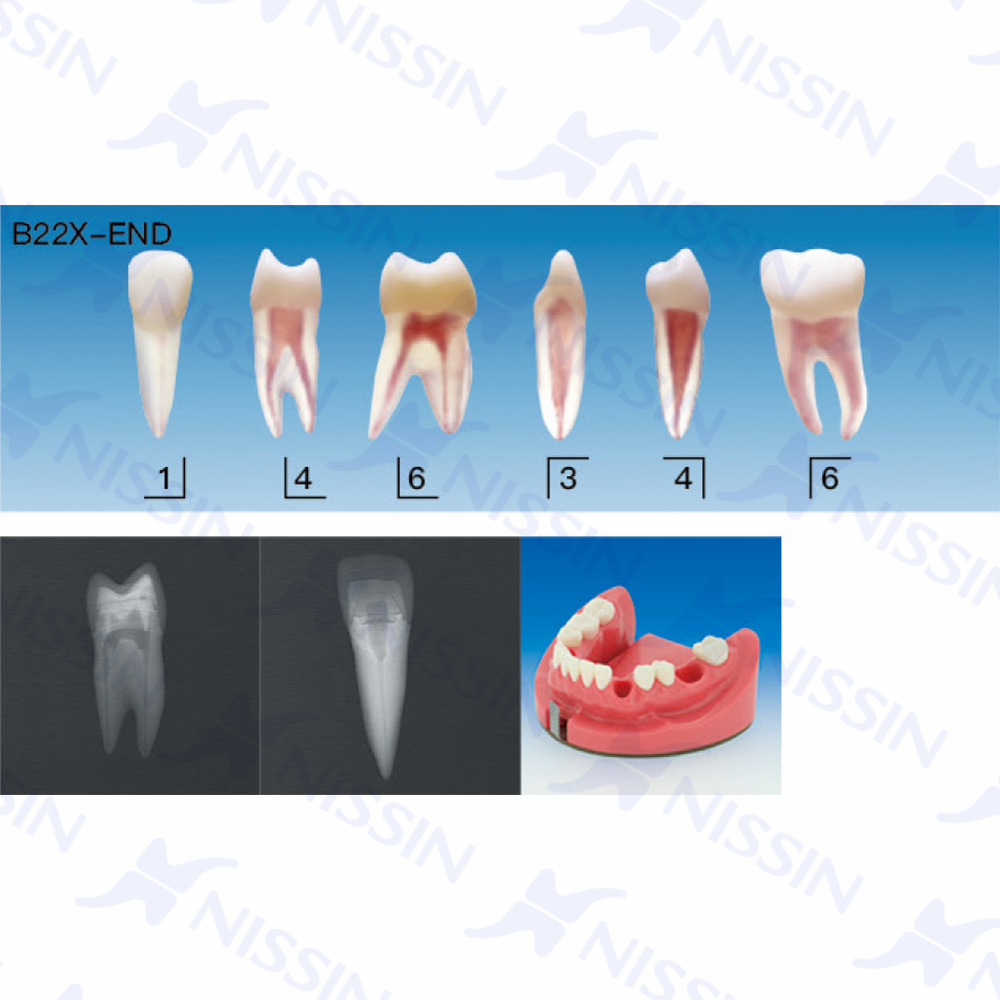 带髓腔根管牙体模型