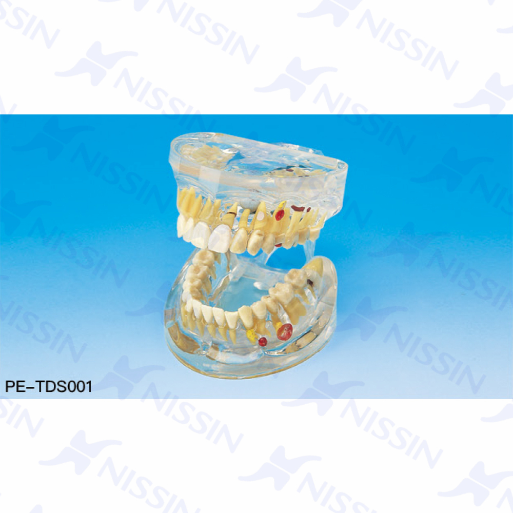 完全透明上下颌综合病理模型