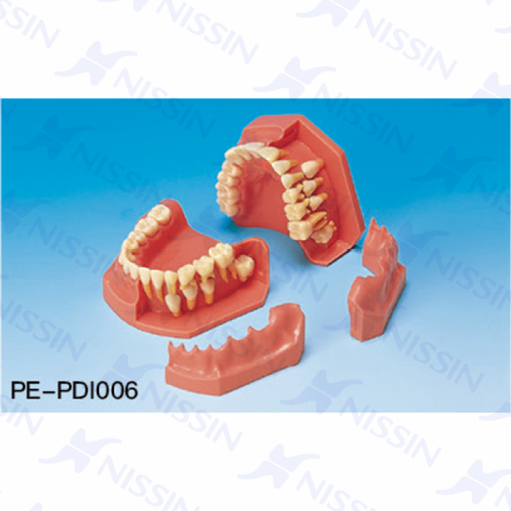 牙列发育模型(12/9岁)