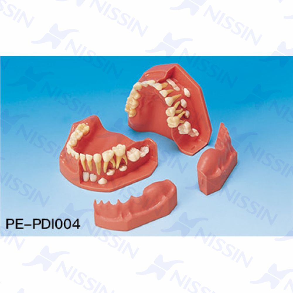牙列发育模型(6/3岁)