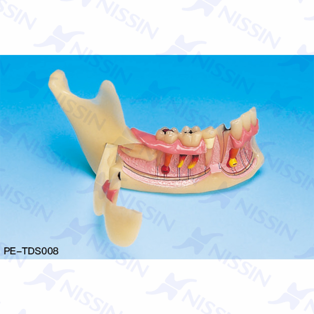 下颌骨组织模型