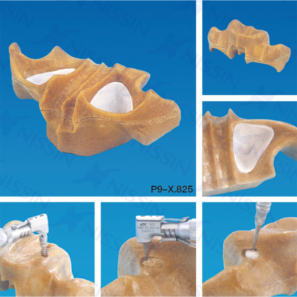 上颌窦底提升实习用模型