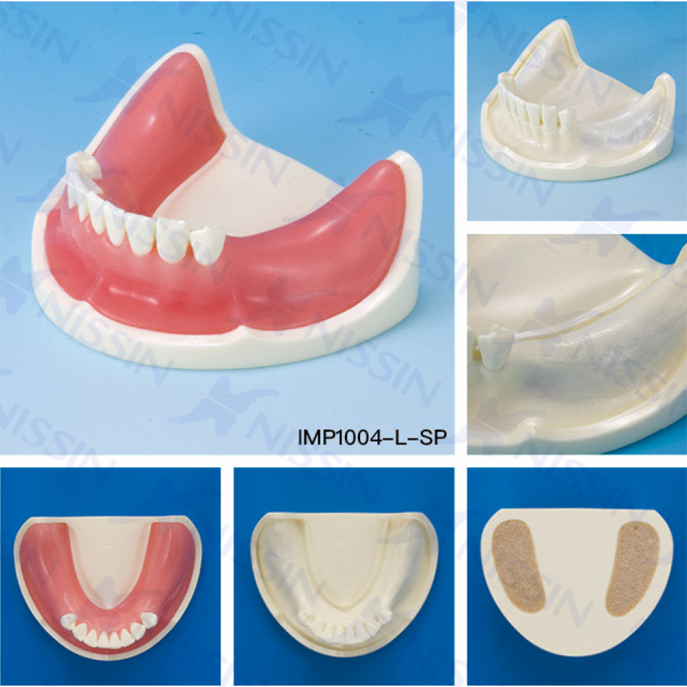 种植实习用牙颌模型
