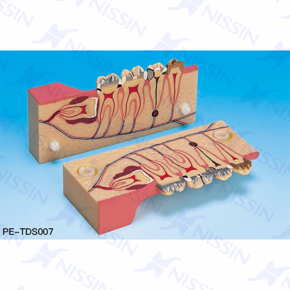 右下后牙分解组织模型